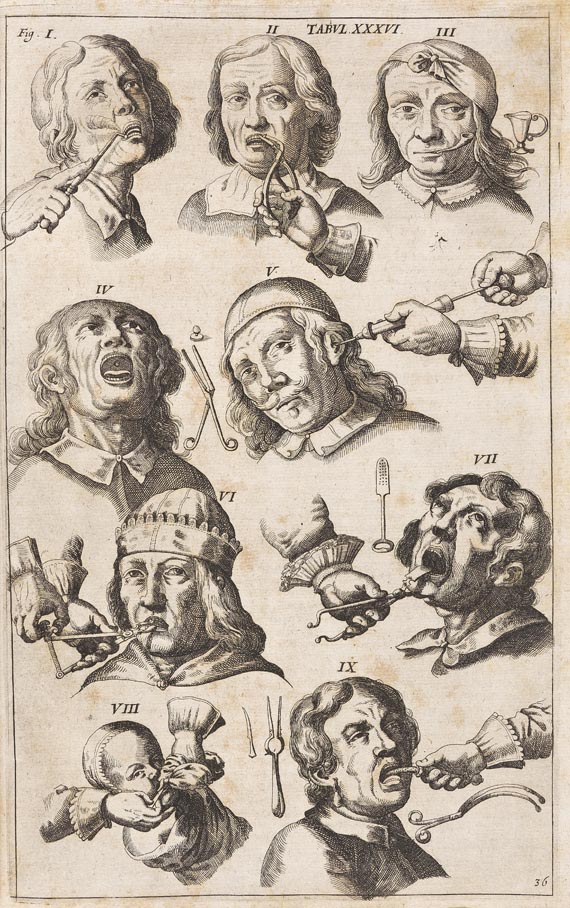 Johann Scultetus - Armamentarium. 1655